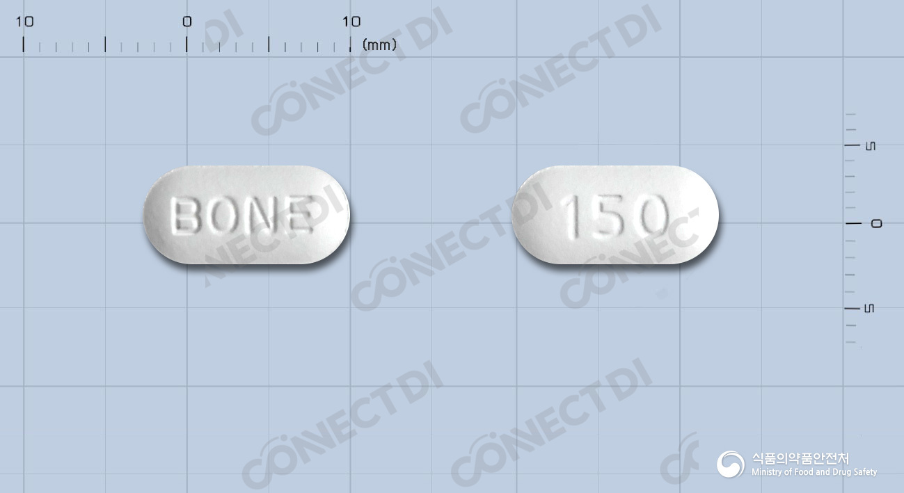 이반네이트정 150mg